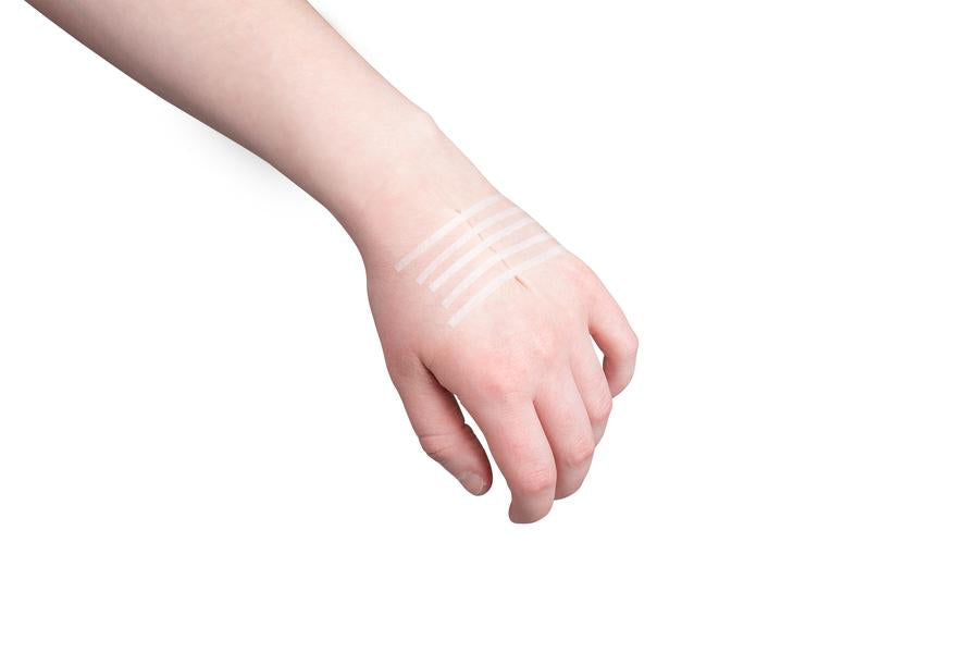 woundclosurestripsinuse900x-1.jpg